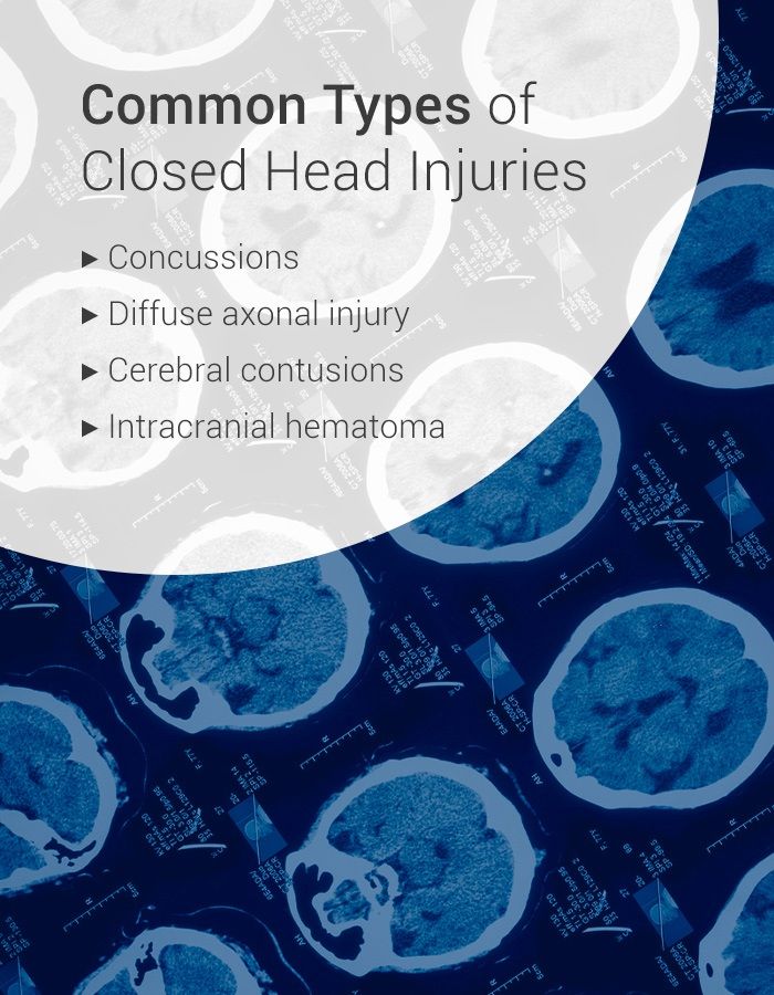 Closed Head Injuries